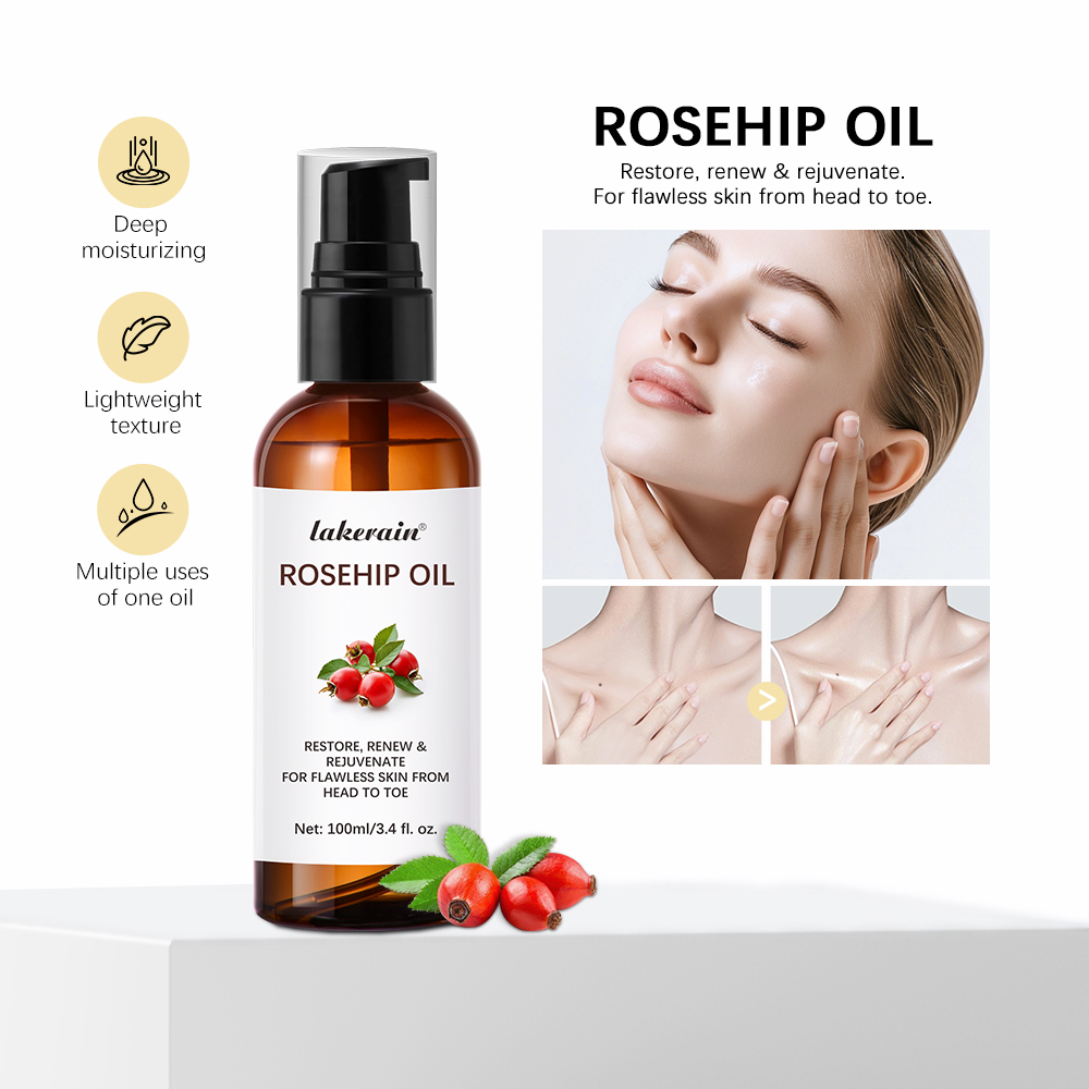 Face Oil Rosehip - น้ำมันโรสฮิปออร์แกนิค 30 มล. ซึมซาบเร็ว ลดเลือนริ้วรอย รักษาแผลเป็น